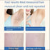 IPL laser Freezing Point Hair Removal Device - MiamiTeenyWeenyBikini.Com