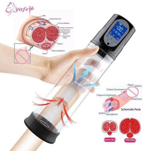 Electric Penis Pump - MiamiTeenyWeenyBikini.Com